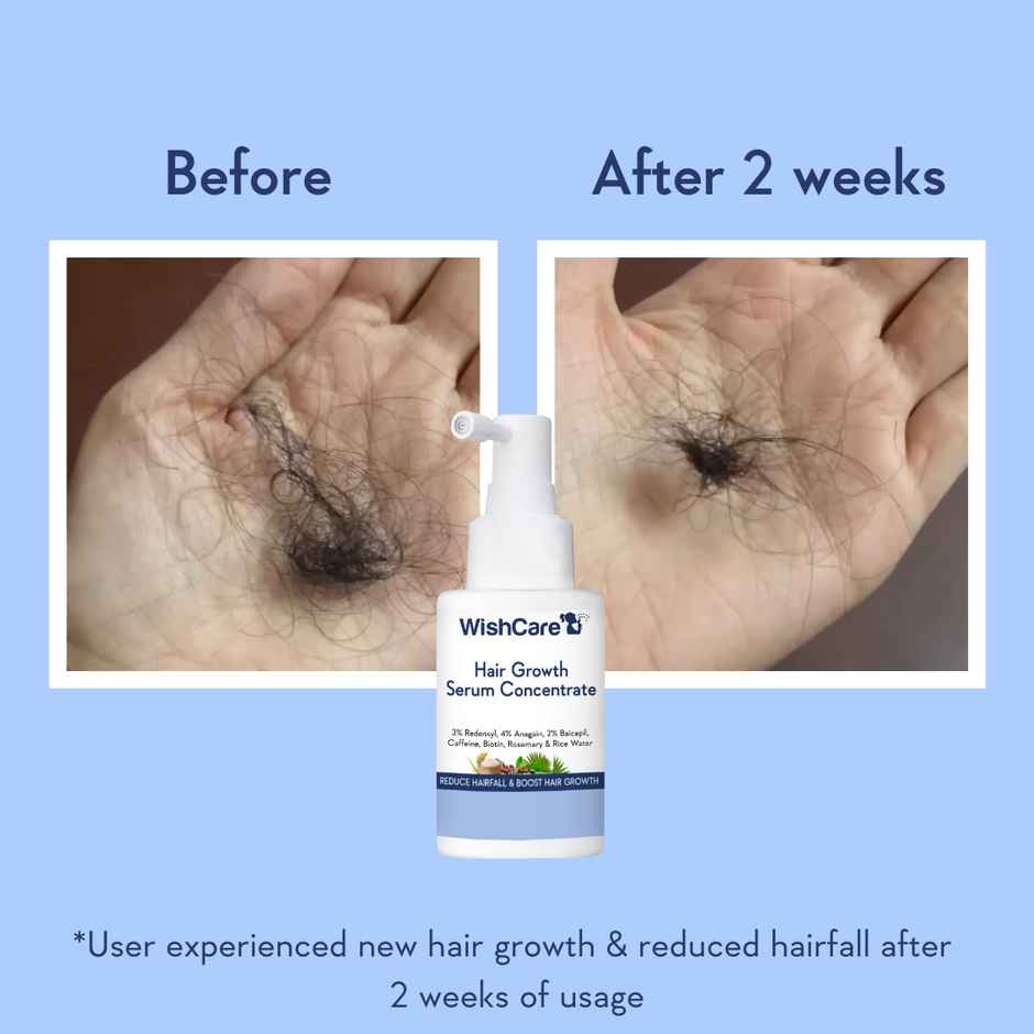 WishCare Hair Growth Serum Concentrate | New Hair Growth in 8 weeks | Redensyl, Anagain & Rosemary