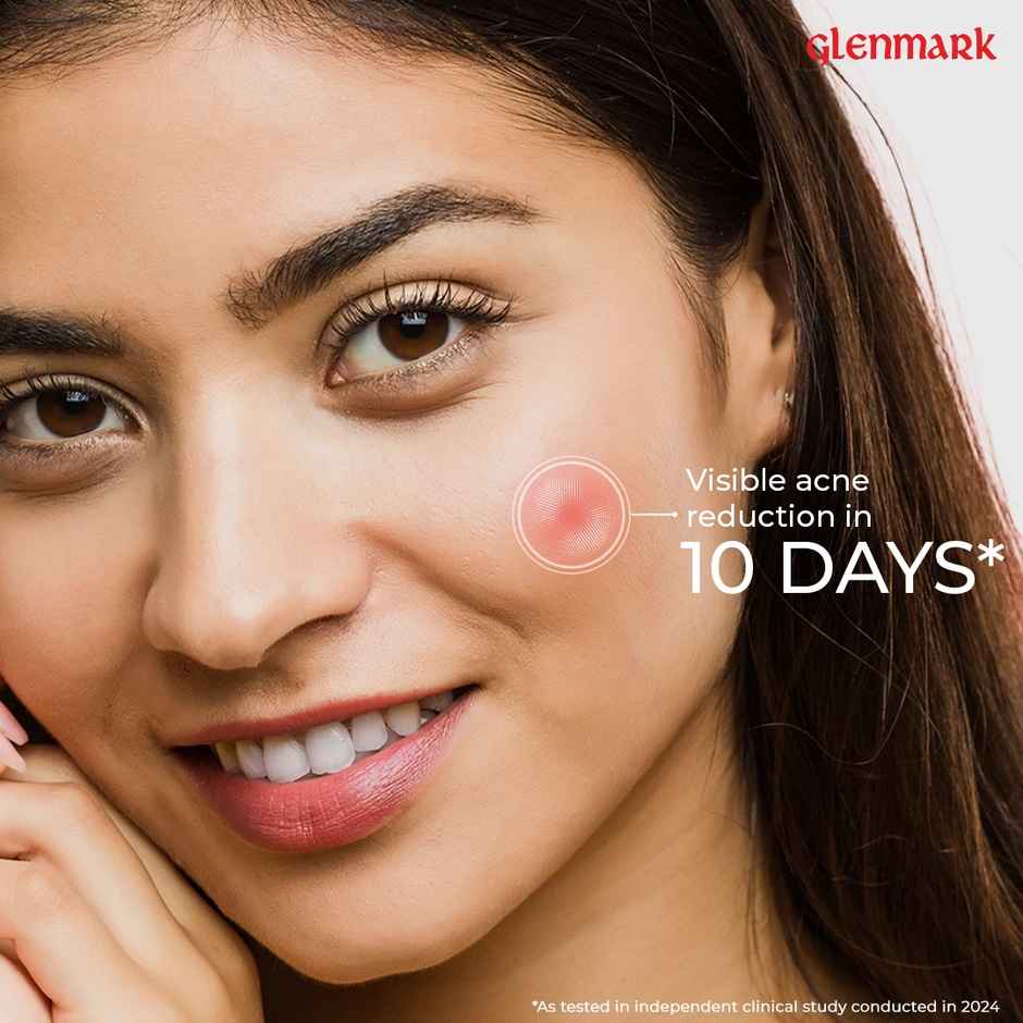 D'Acne Soft Face Wash Unclogs Pores And Prevents Pimples