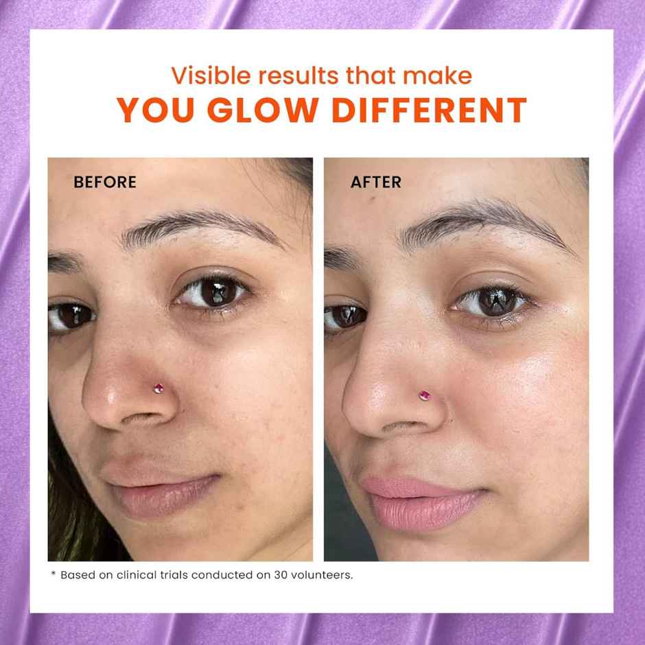 Foxtale Skin Radiance Detan Face Mask for Instant Tan Removal