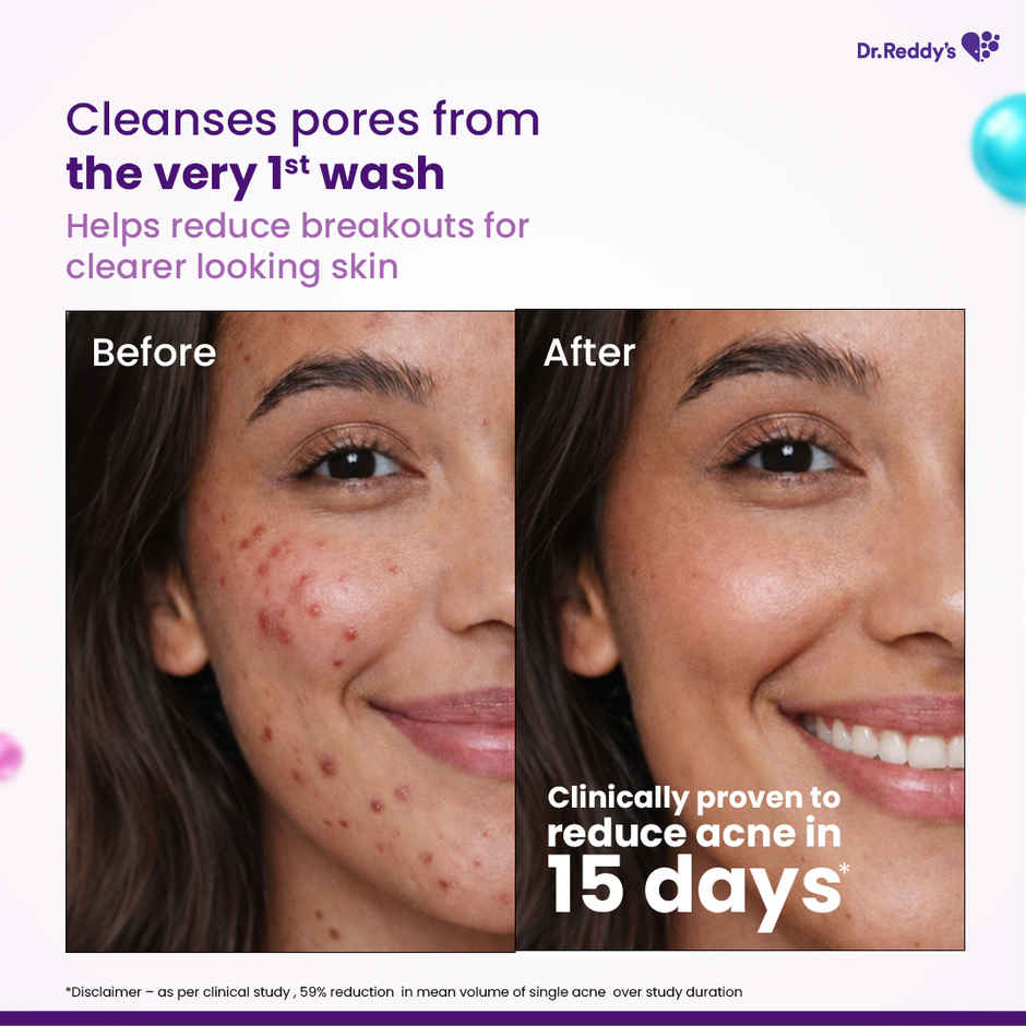 Dr. Reddy's Venusia Acne Facewash