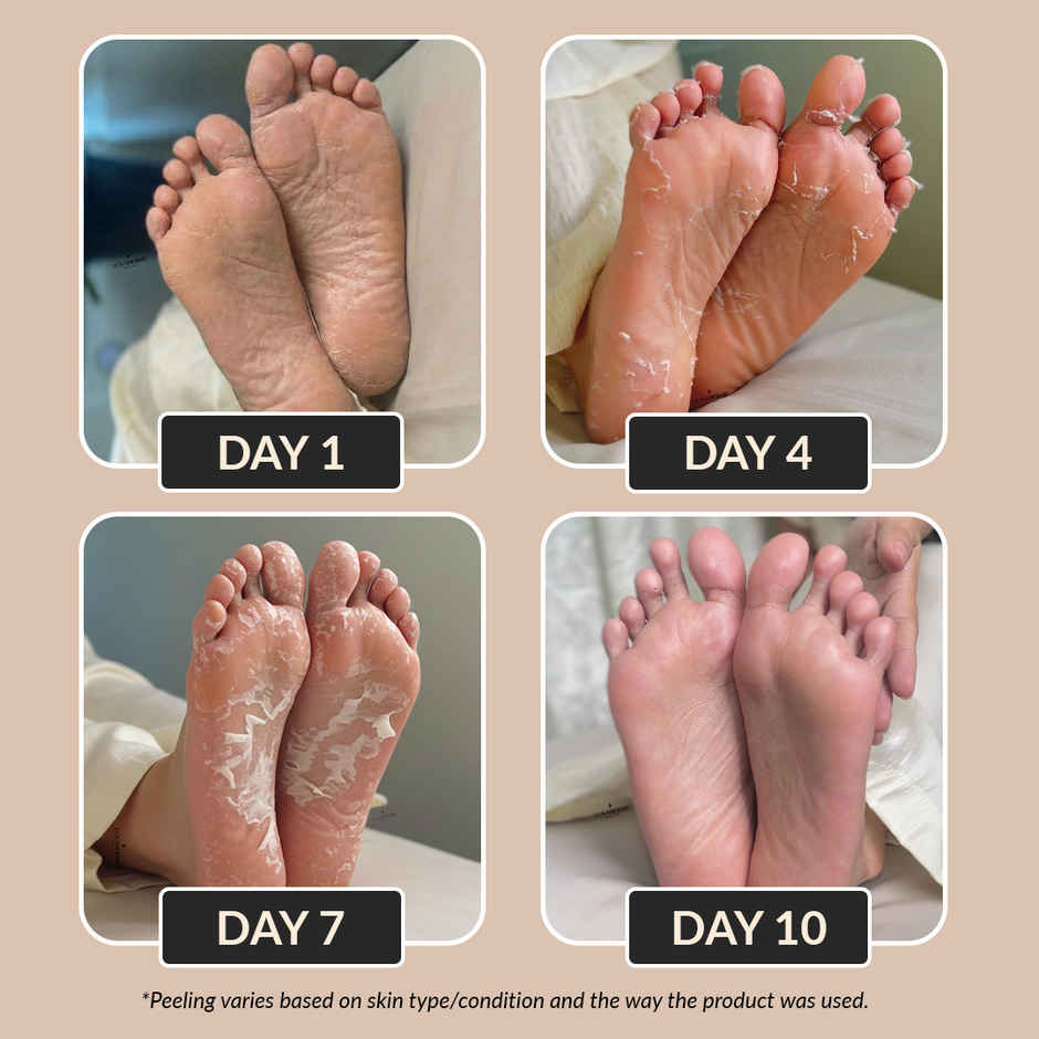 LuxaDerme Peeling & Exfoliating Foot Mask