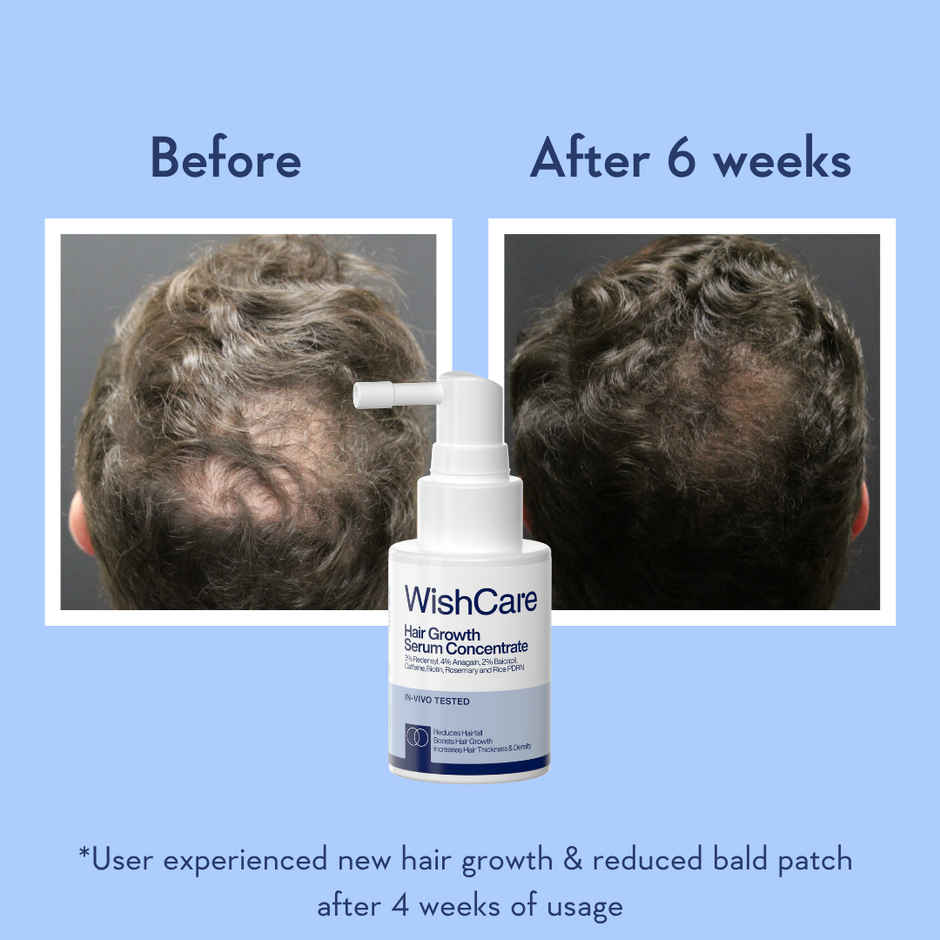 WishCare Hair Growth Serum Concentrate | New Hair Growth in 8 weeks | Redensyl, Anagain & Rosemary