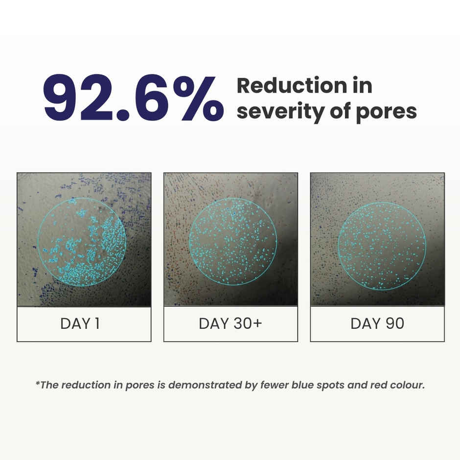 Re'Equil 0.3% Retinol Night Cream | Improves Skin Texture | Reduces Acne | For All Skin Types