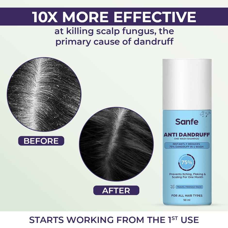 Sanfe Anti Dandruff One Wash Shampoo Removes Dandruff, Helps With Itching & Irritation