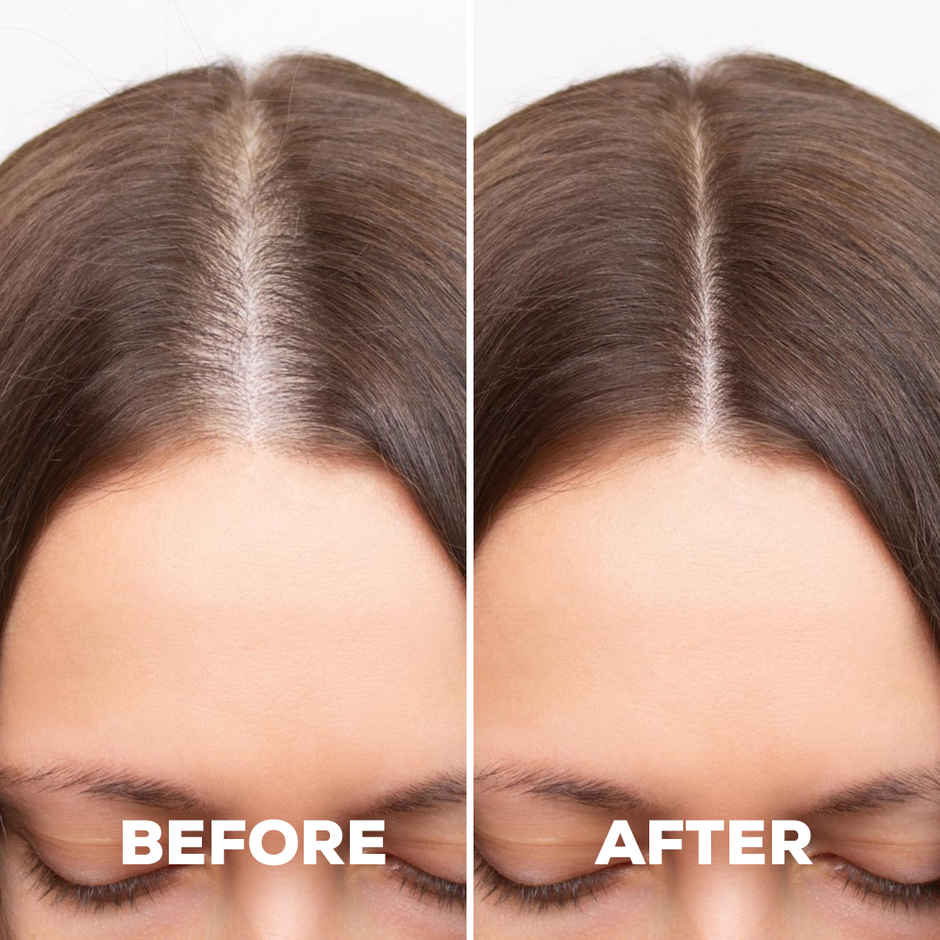 Multibrite Derma Roller for Face Massager For Hair Growth | Micro Needles Roller Skin Care Tool