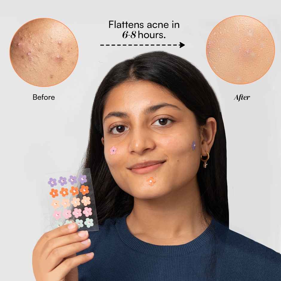 Gush Beauty Dart It Pimple Patches | Pink Hearts & Stars | Heals Acne | Zits & Blemishes