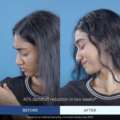 Arata Anti-Dandruff Hair Conditioner