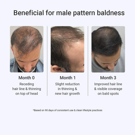 Arata 3% Redensyl & 3% Procapil Hair Growth Serum