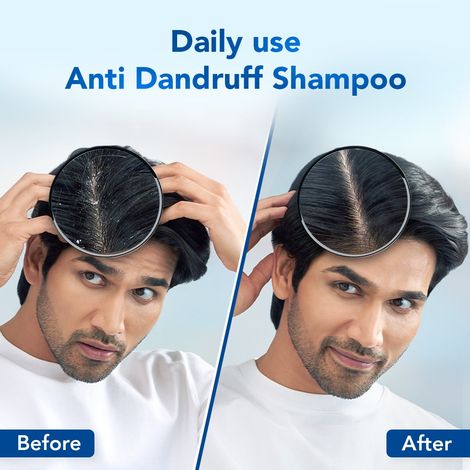 Scalpe Pro AntiDandruff Shampoo Removes Dandruff Strong Hair For Women & Men