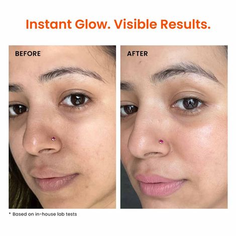 Foxtale Skin Radiance Face Mask for Detan