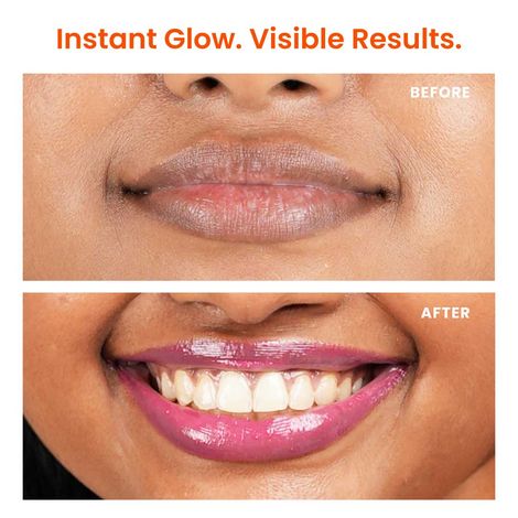 Foxtale SPF 30 Brightening Lip Balm with Peptitdes (Pink)