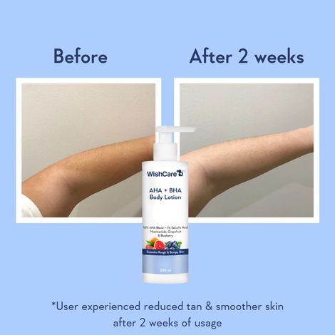 Wishcare Spf50 Niacinamide Sunscreen Body Lotion With No White Cast (200g) & Wishcare 10% Aha + 1% Bha Body Lotion With Niacinamide - Smooths Rough  Bumpy Skin (200g) Combo