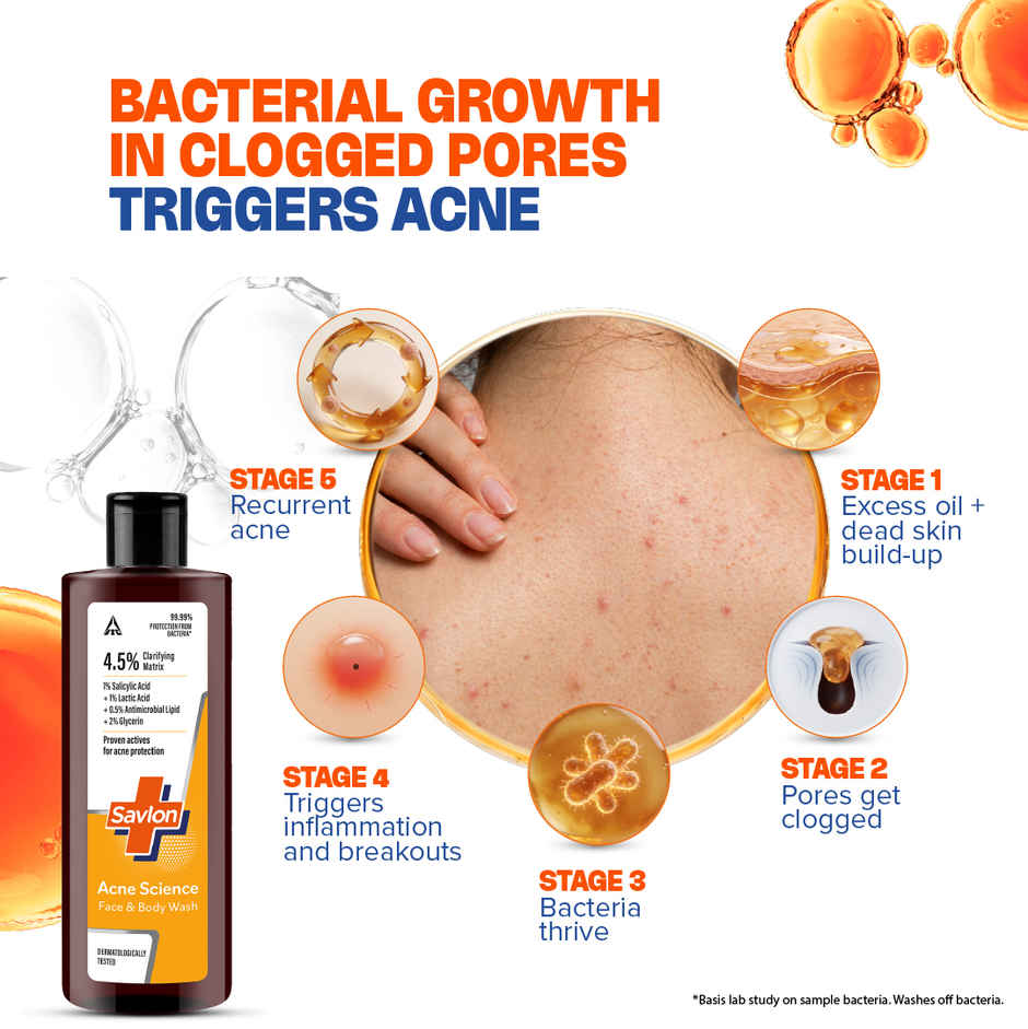 Savlon Acne Science Face & Body Wash