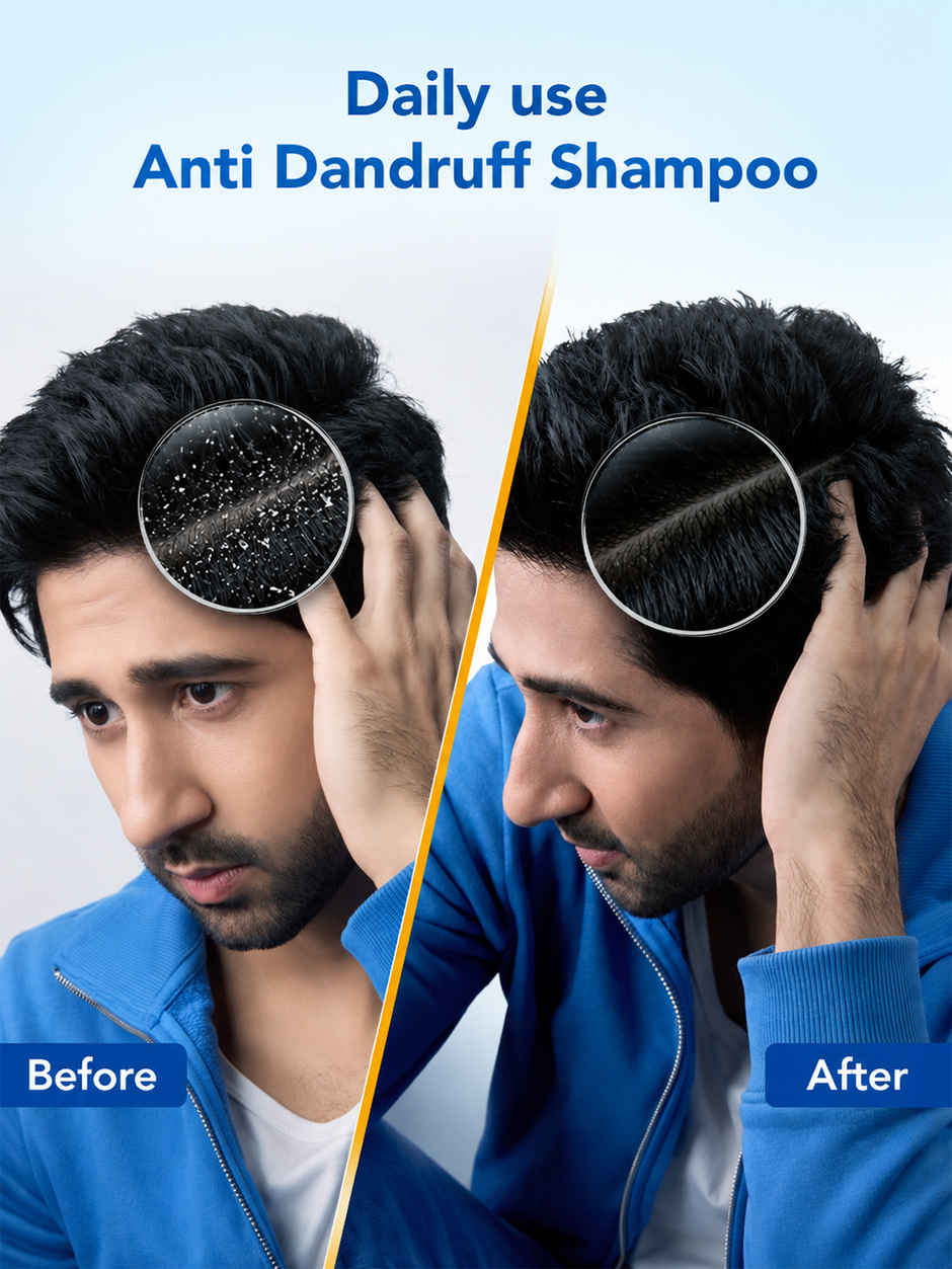 Scalpe Pro Anti dandruff Shampoo 100ml