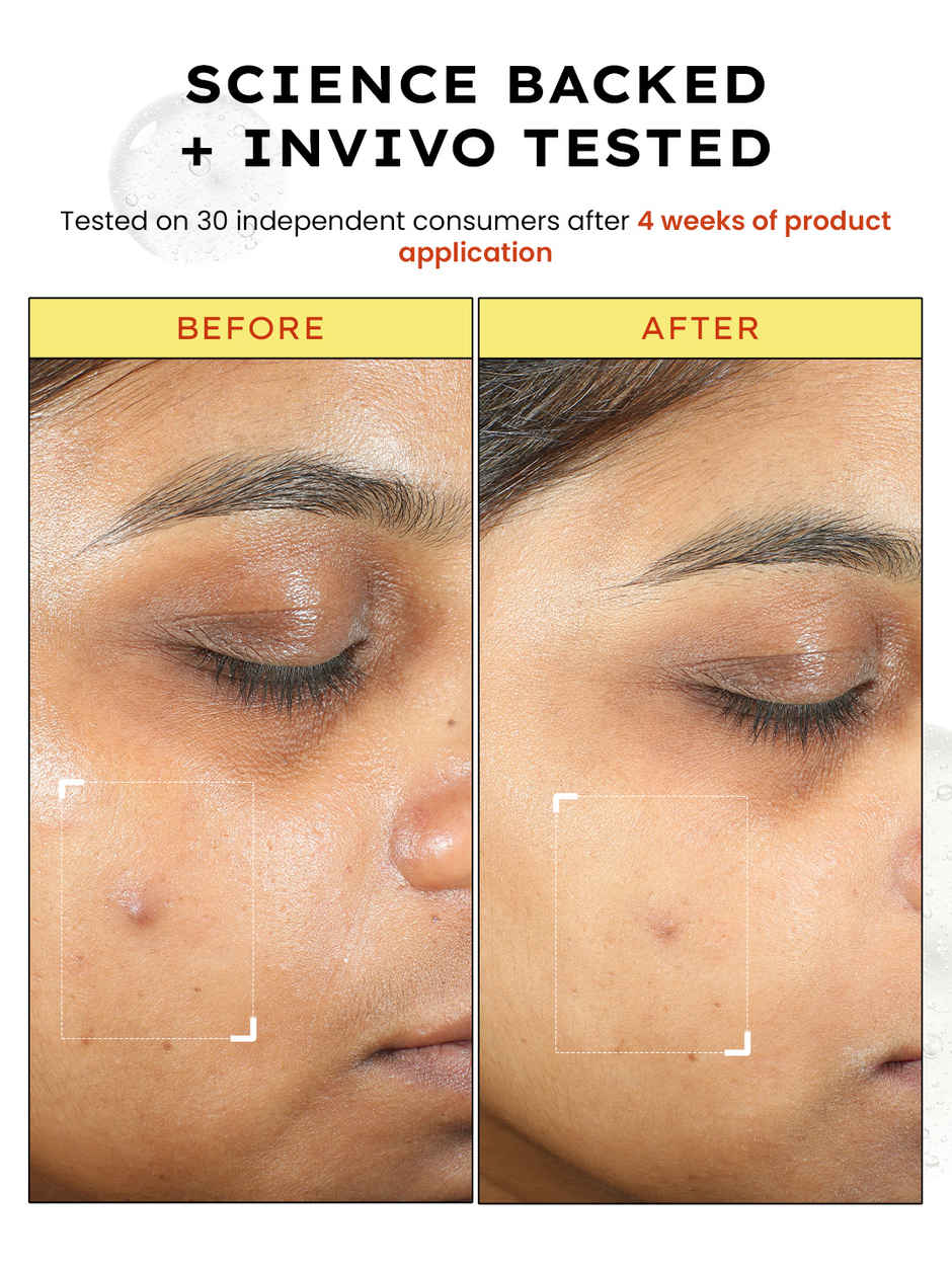 Hyphen 10% Vitamin C 1% E and Ferulic Acid Serum Brightens and Fades Dark Spots