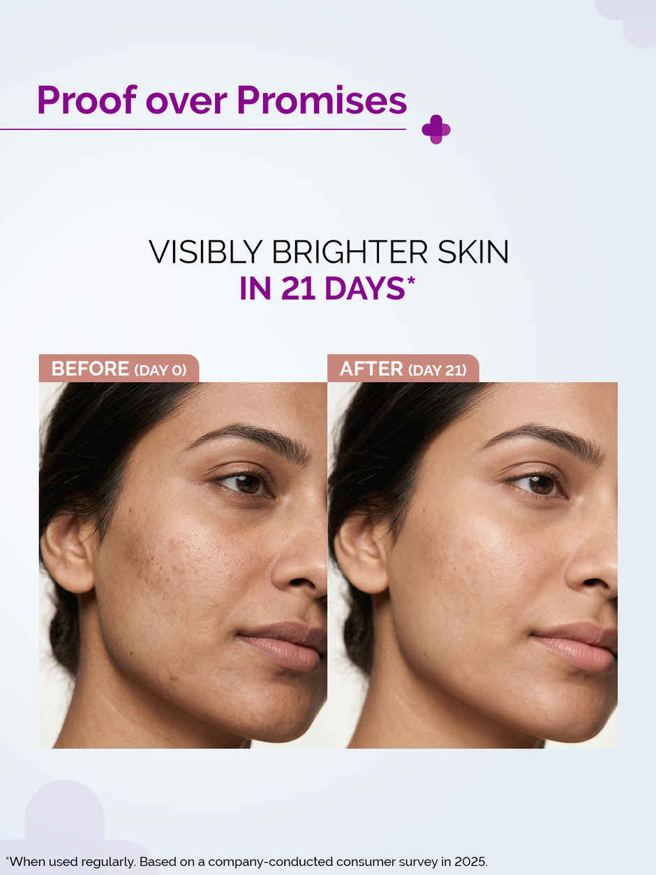 The Derma Co 10% Vitamin C Face Serum for Skin Radiance