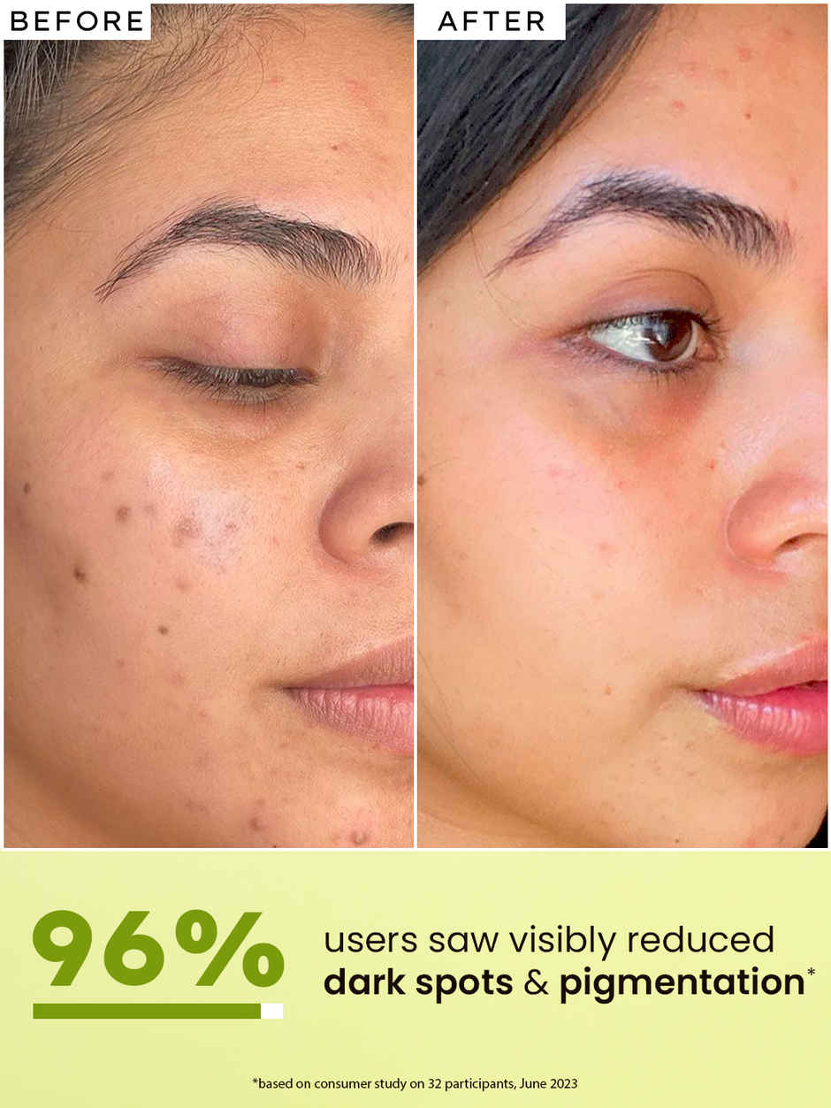 Hyphen Golden Hour Glow Serum