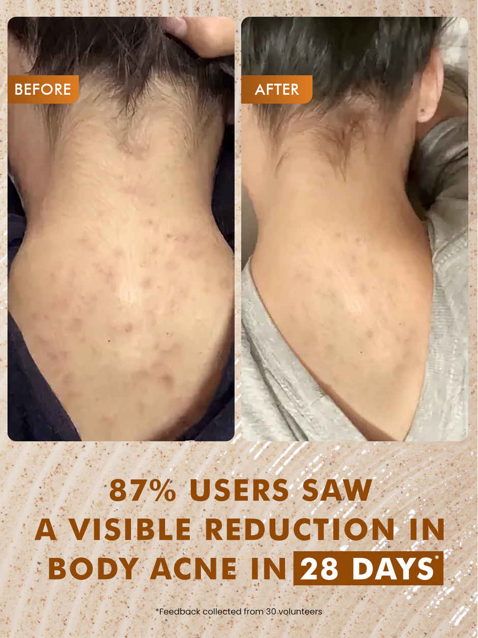 Mcaffeine Caramel Crunch 7% Exfoliating Body Wash with 1% Salicylic 2% Lactic Acid for Body Acne