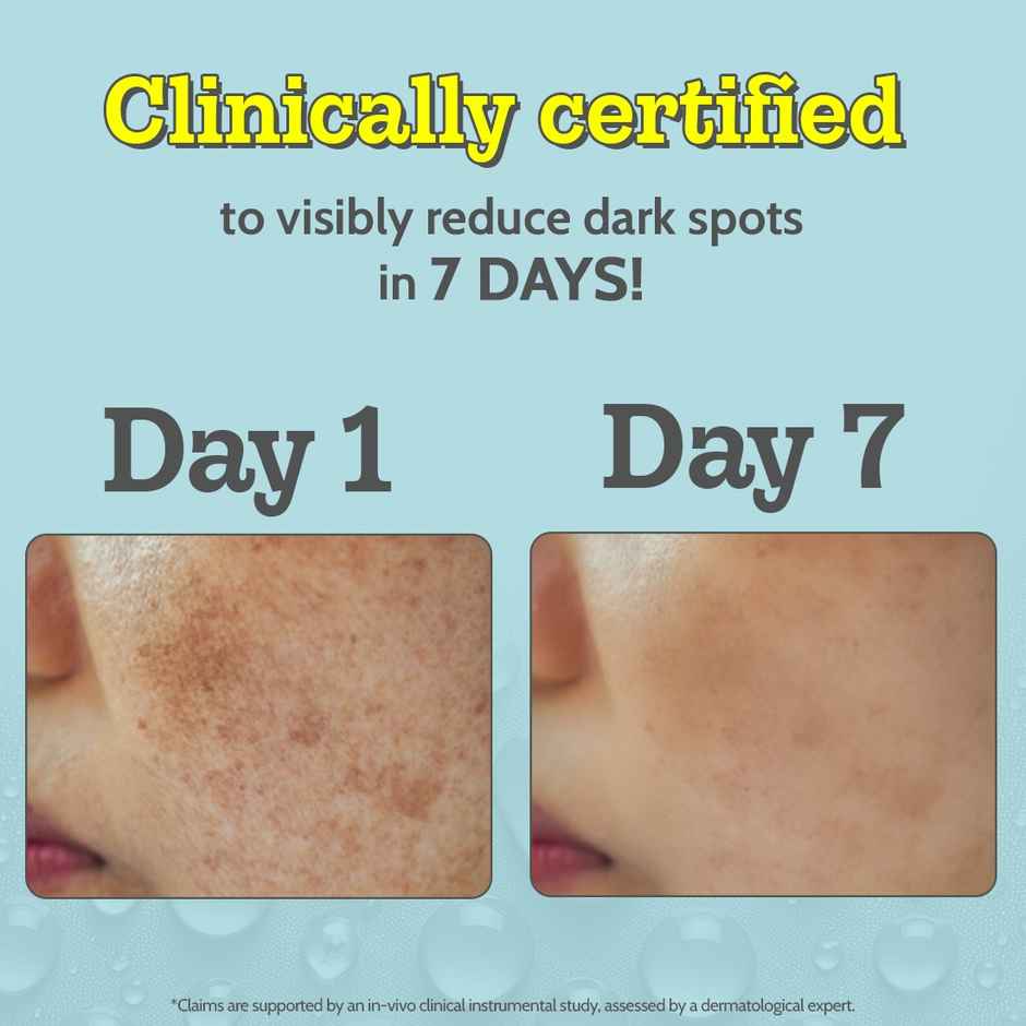 Chemist At Play 10% Vitamin C Face Serum | Brightens Skin | Treats Spots, Hyperpigmentation