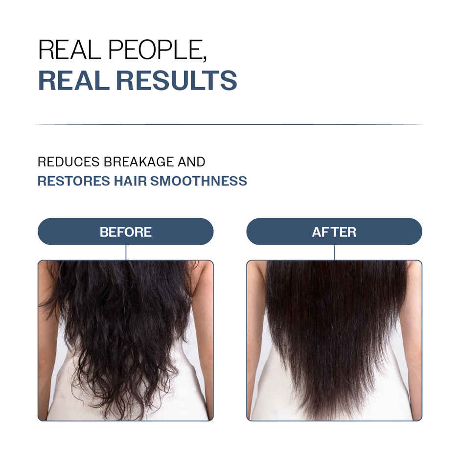 Bare Anatomy Anti-Hair Fall Conditioner for Hair Fall & Thinning with Redensyl + Rosemary