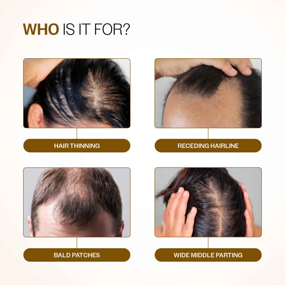 Bare Anatomy Advanced Hair Growth Serum Roll-On | Redensyl, Anagain, Rosemary, Rice Water