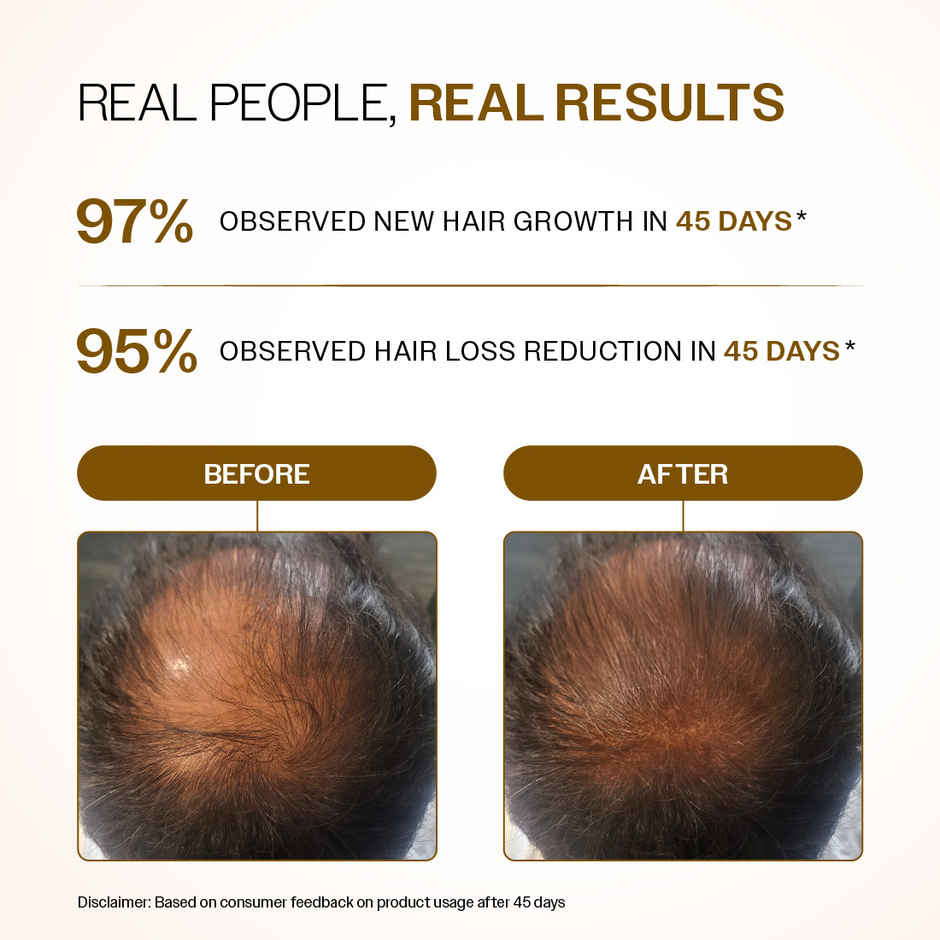 Bare Anatomy Advanced Hair Growth Serum Roll-On | Redensyl, Anagain, Rosemary, Rice Water