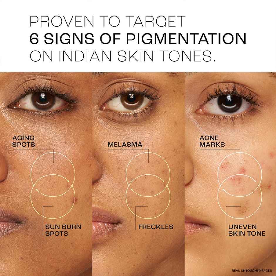 Lakme Perfect Radiance Serum With 15% Niacinamide Resorcinol Pro Retinol Complex