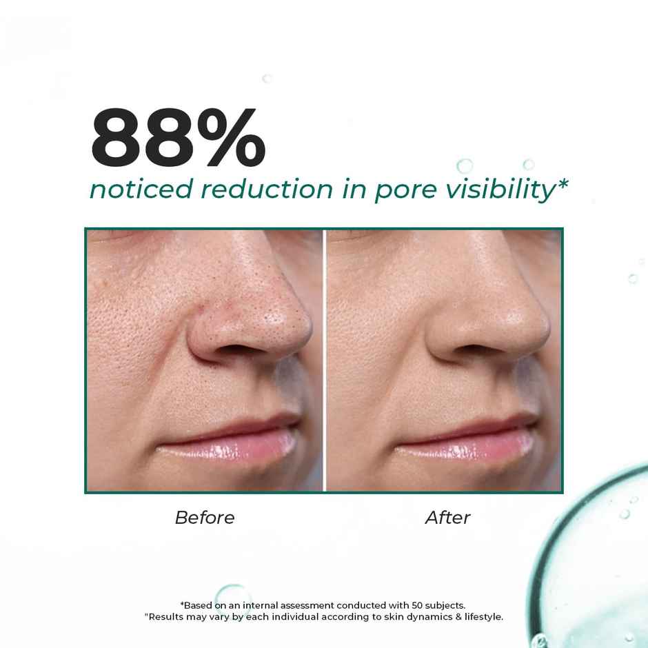 Conscious Chemist Blackhead Melting Water with Succinic & Glycolic Acid for Clear, Smooth Skin