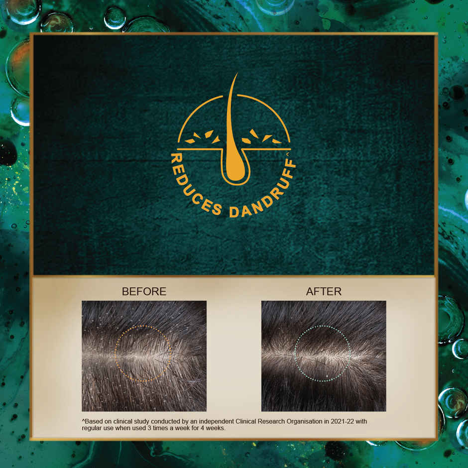 Indulekha Dandruff Treatment Shampoo