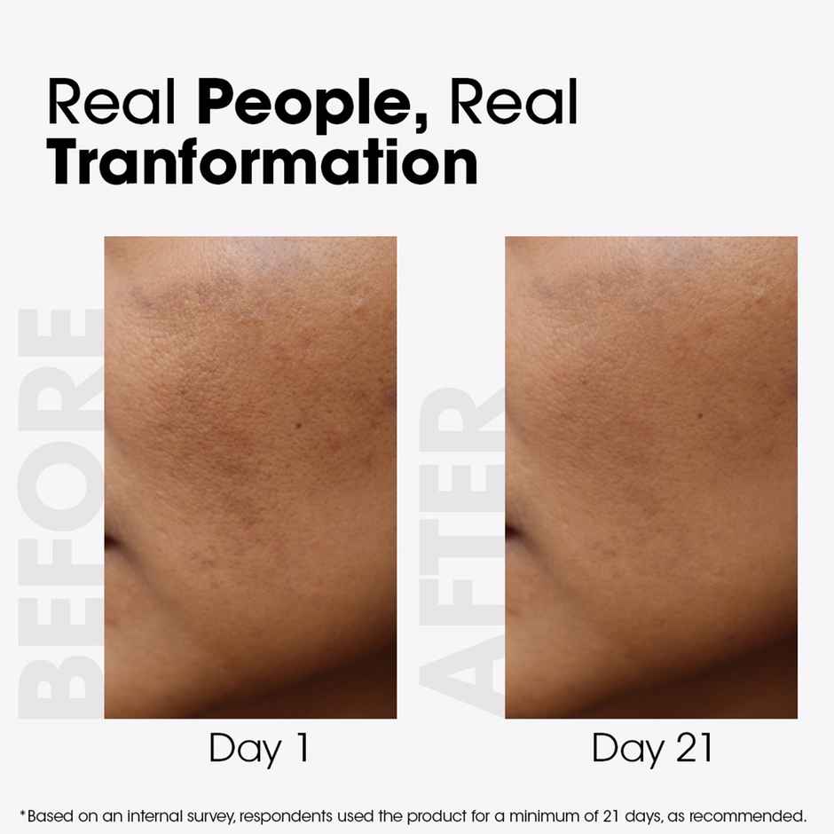 TAC 100% Pure Kumkumadi Gold Glow Face Oil Brightens, Reduces Pigmentation & Wrinkles