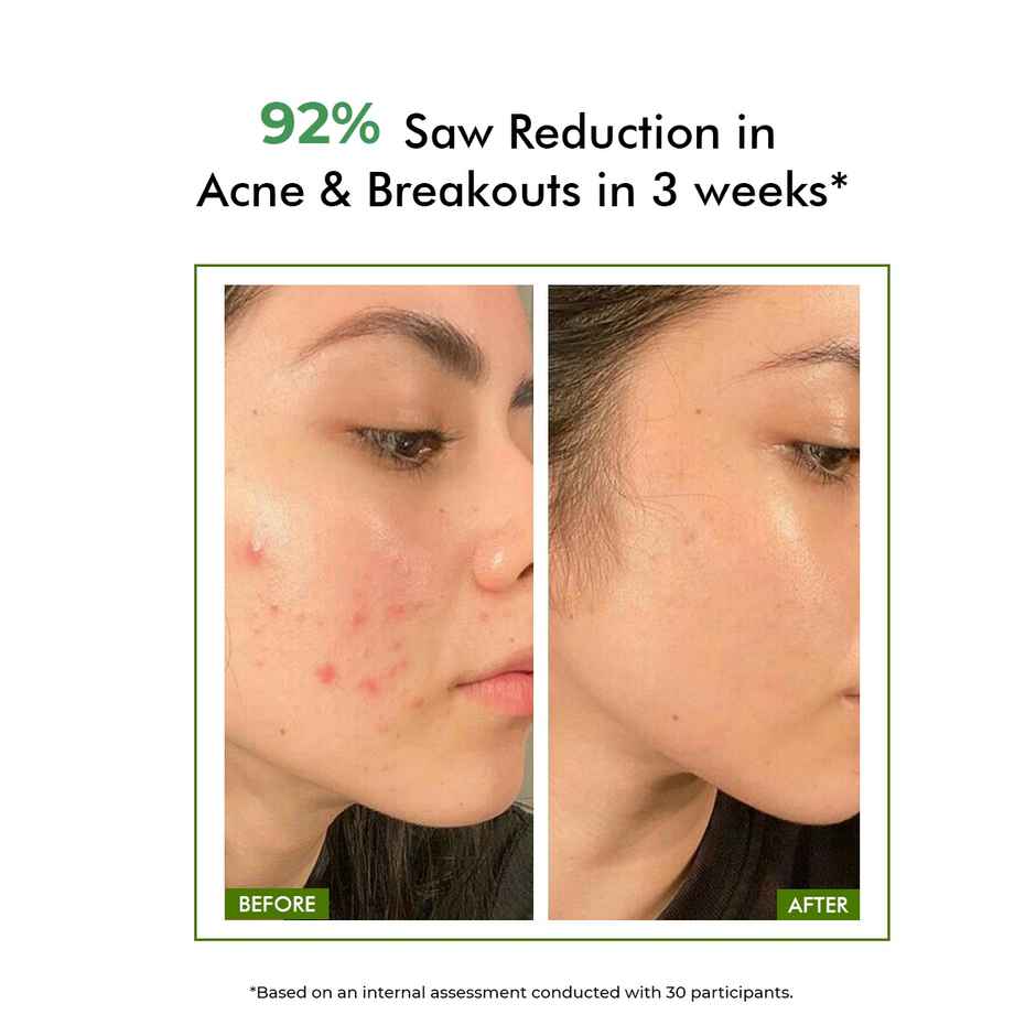 Conscious Chemist Salicylic Acid Face Wash For Oily Acne Prone Skin With Glycolic Acid