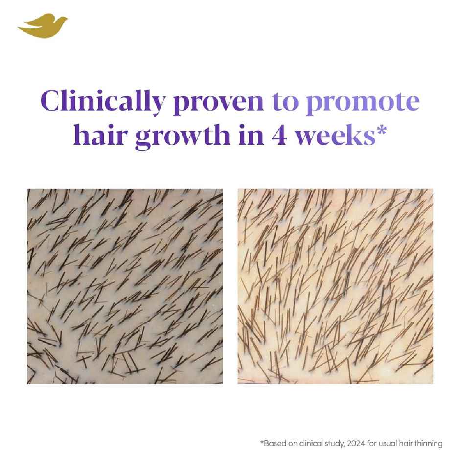 Dove Scalp+Hair Density Boost Serum: 2.5% Niacinamide & 1.5% Zinc Peptides For Revitalizing Scalp