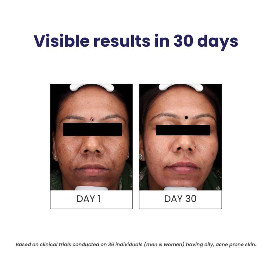 Re'equil Oil Control Face Wash