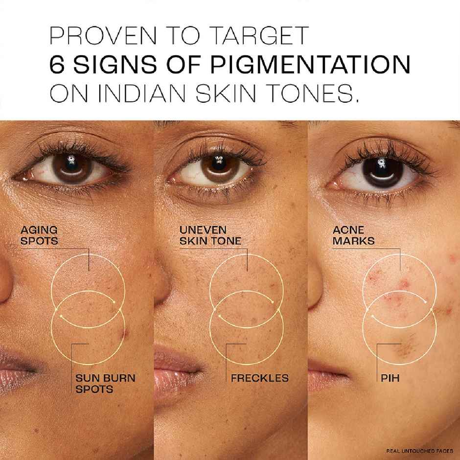 Lakme Perfect Radiance Day Gel Creme With 10% Niacinamide Resorcinol Complex & Antioxidants