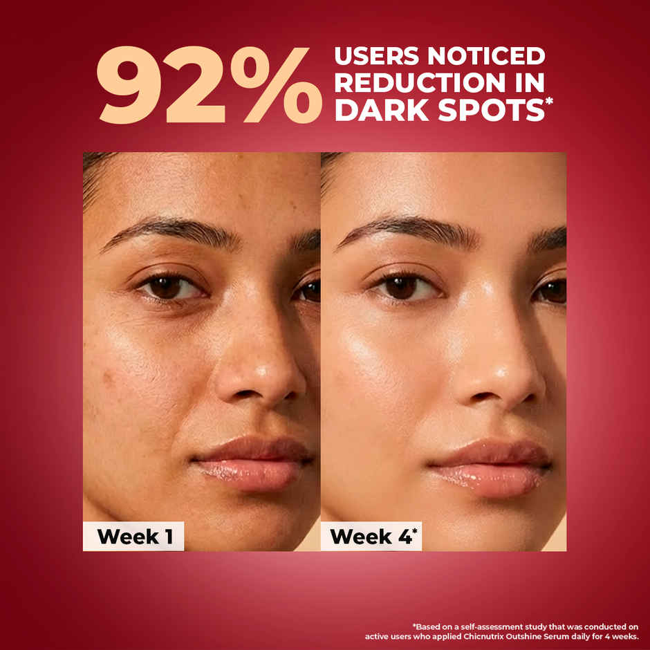 Chicnutrix Outshine - Korean Dark Spot Correction Serum