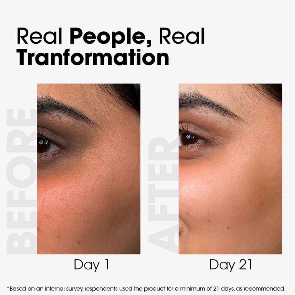 TAC Acne & Spot Correction Face Serum Treats with Neem Acne & Fades Spots | For Oily Skin