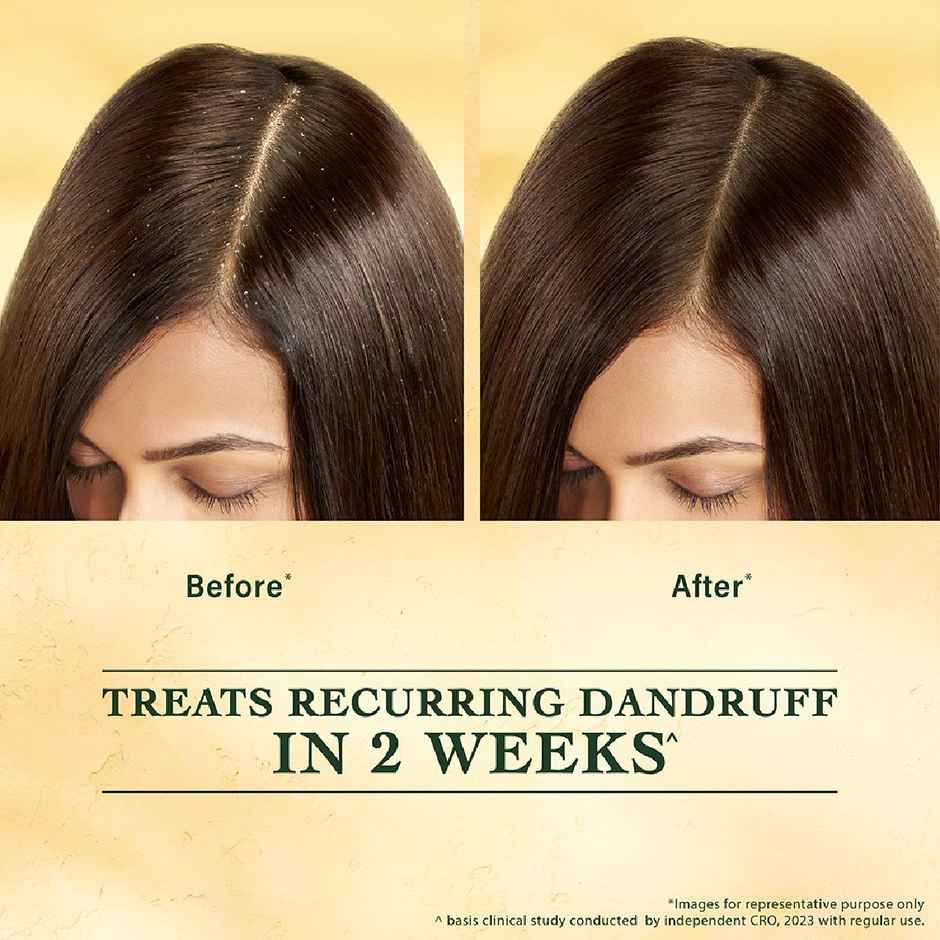 Indulekha Svetakutuja Dandruff Treatment Scalp Serum|Ayurvedic Serum For Dandruff Treatment
