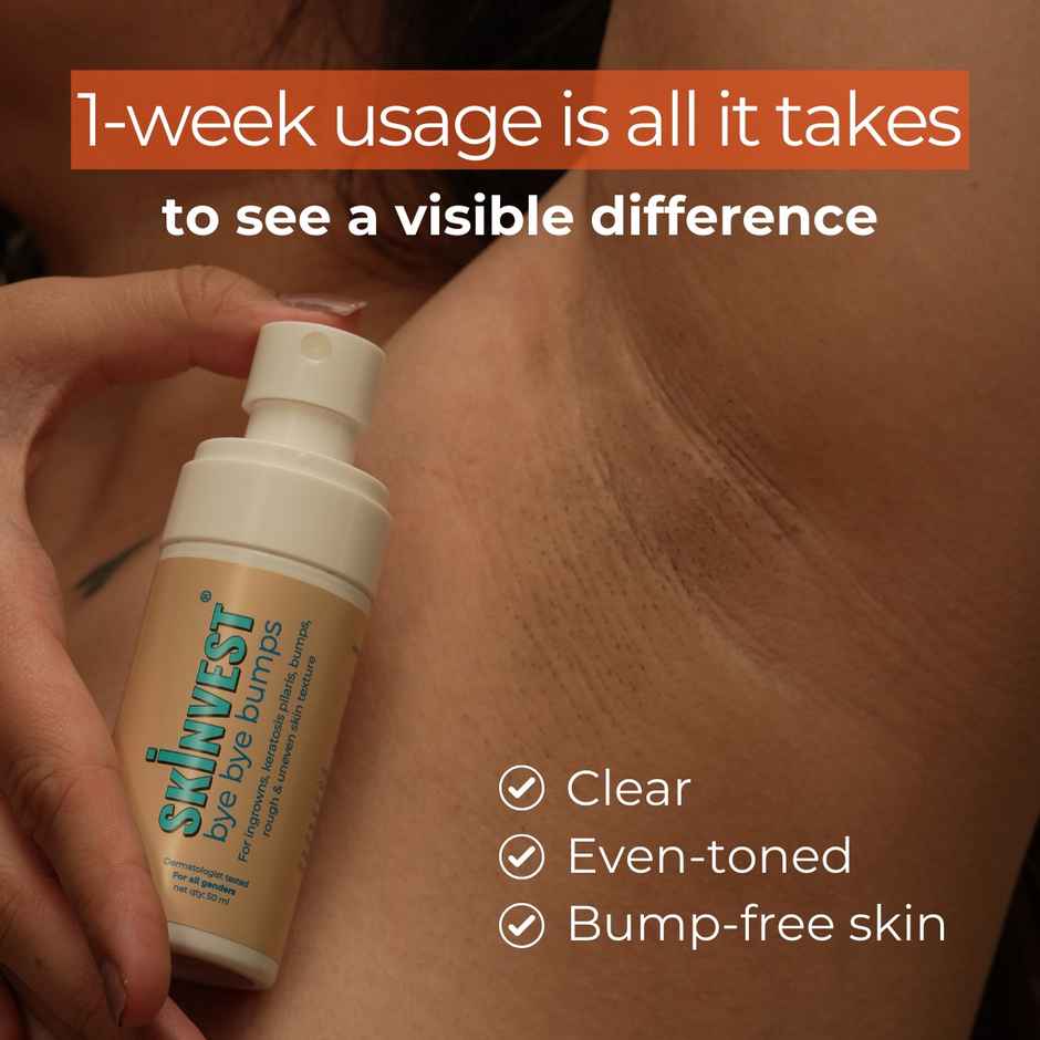 Skinvest Bye Bye Bumps For Men & Women