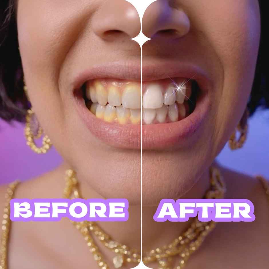 Closeup White Now Stain Eraser Toothpaste Combo