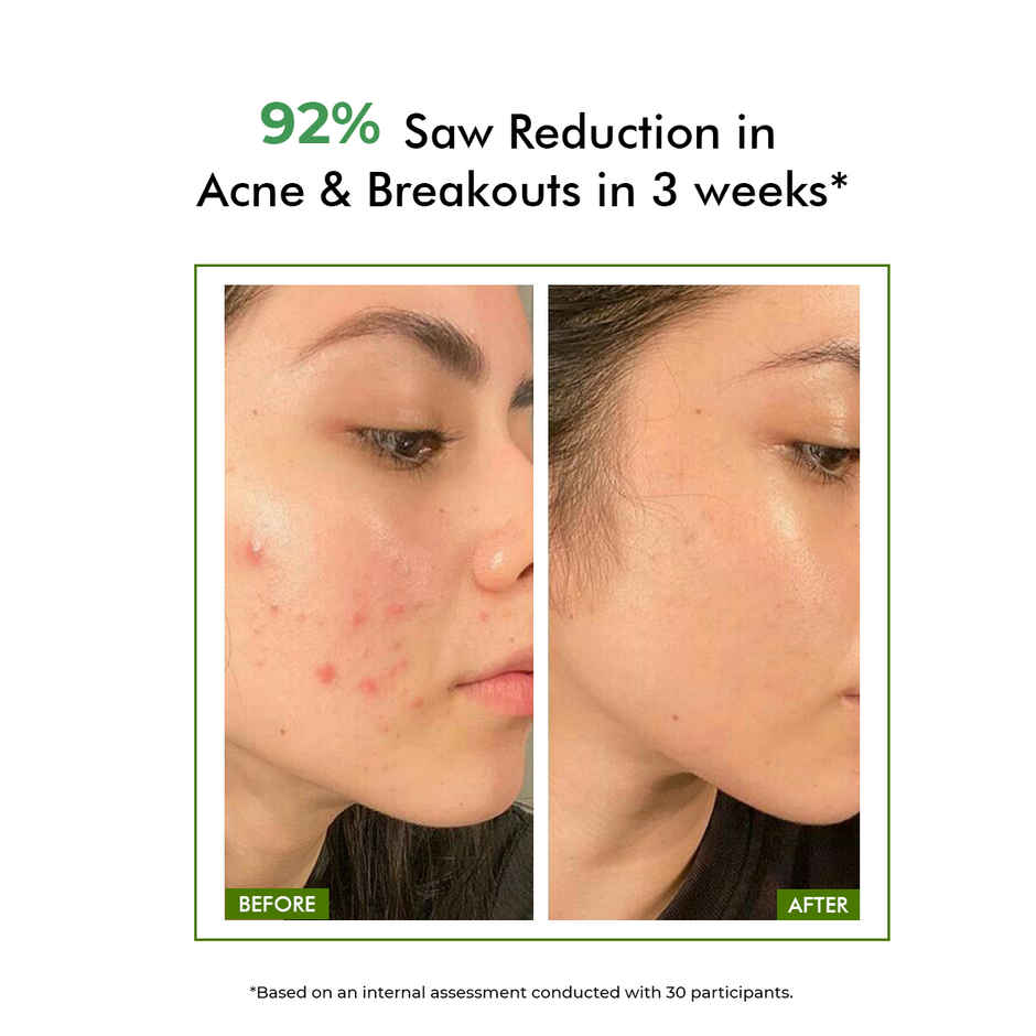 Conscious Chemist Salicylic Acid Face Wash For Oily Acne Prone Skin With Glycolic Acid