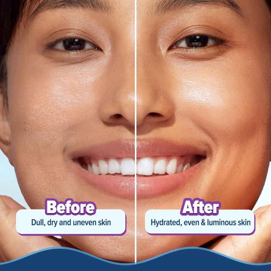 Aqualogica Illuminate + Hydra Gel Moisturizer With Alpha Arbutin For 24 Hour Intense Hydration | Tested On GenZ