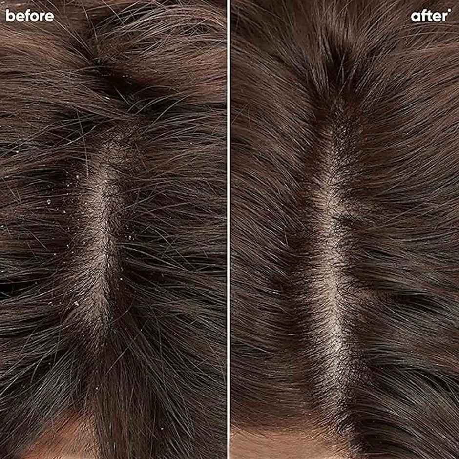 BIOLAGE SCALPPURE Anti-Dandruff Shampoo, 72 HR Scalp Detox, Vegan, No Added Parabens