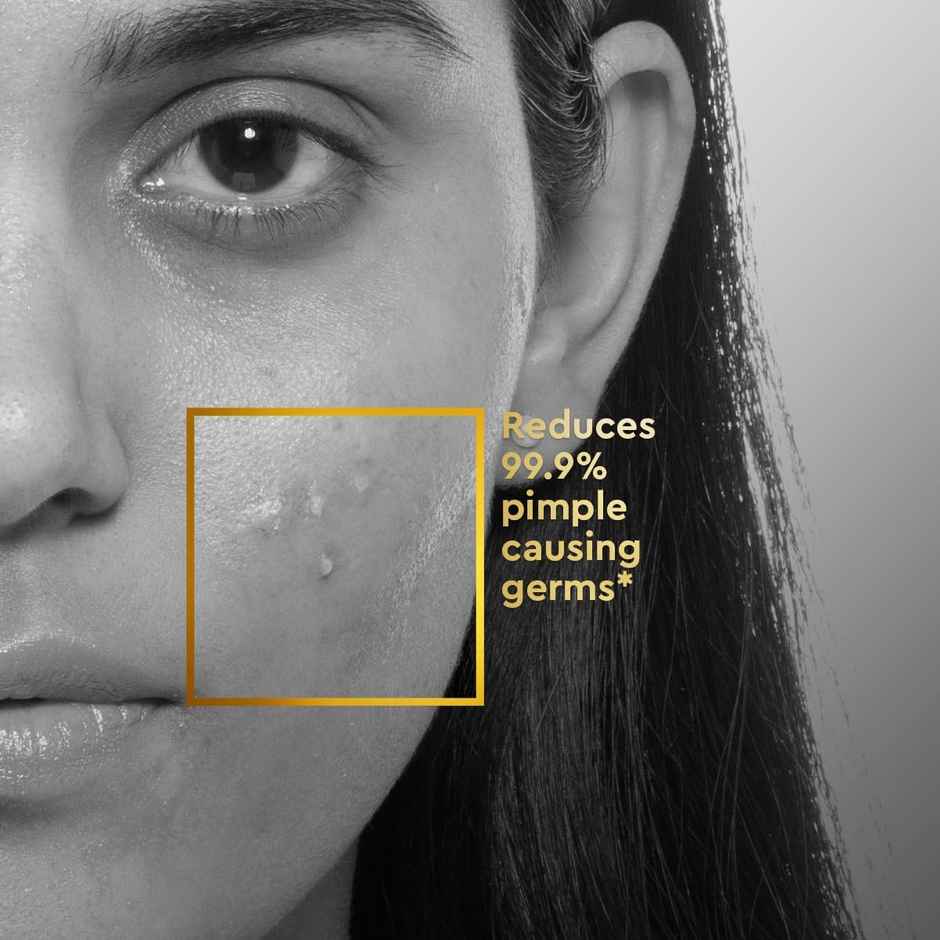 VLCC Clinic Acne Spot Relief