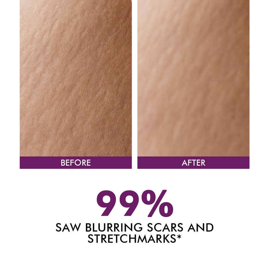 Conscious Chemist Retinol Body Cream Reduces Stretch Marks, Uneven Skin Tone & Scars