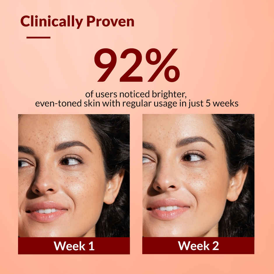 Fixderma Skarfix-TX Face Cream with 2% Kojic Acid for Pigmentation, Blemishes & Dark Spots