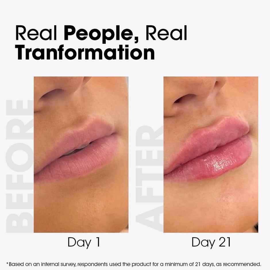 TAC Beetroot Lip Butter With SPF 20, Repairs Dry Lips & Reduces Pigmentation