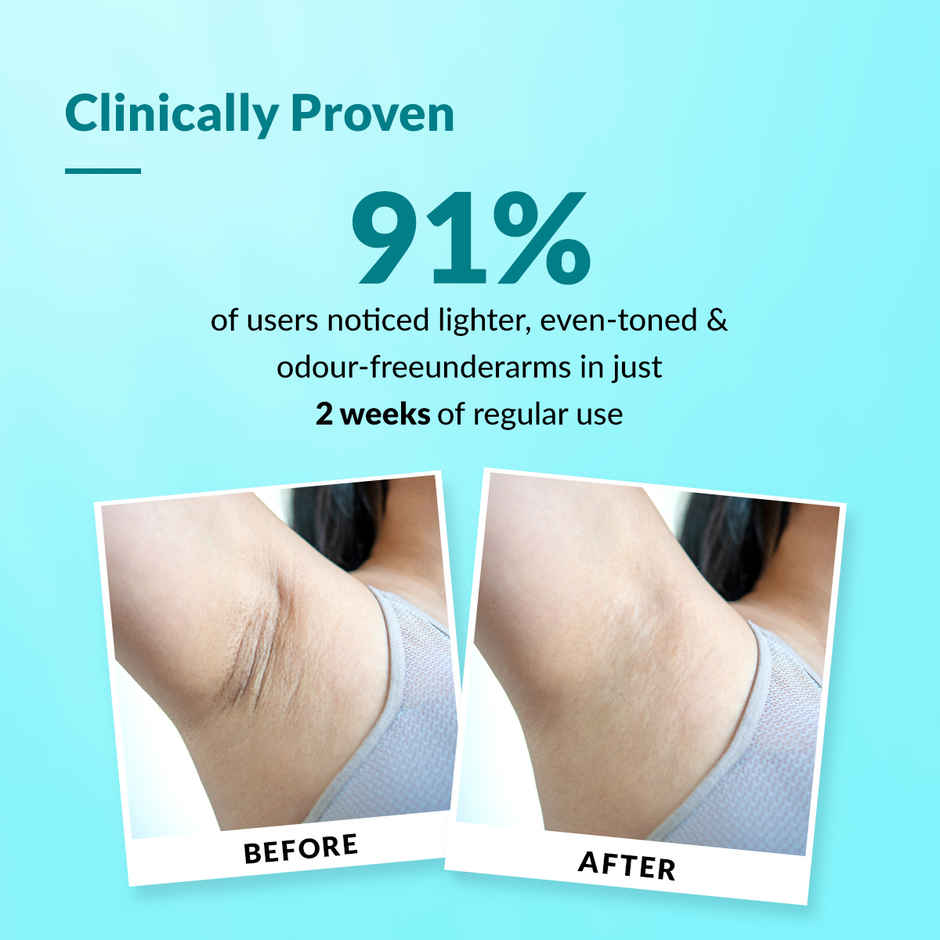 Fixderma Nigrifix 6% AHA Unisex Underarm Lightening Roll On |Reduces Pigmentation & Odour