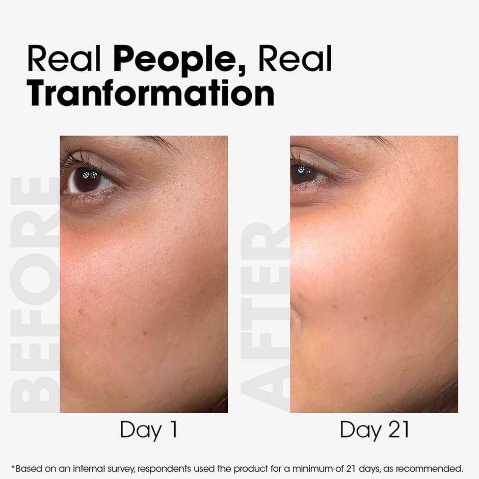 TAC Kumkumadi Face Moisturiser With 24K for Dullness & Pigmentation All Skin Types