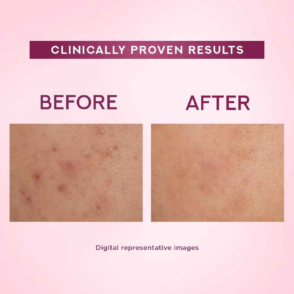 Pond's  Bright Beauty Light Cream With Uv Filter, Niasorcinol, Fades Dark Spots, Brightens Skin, 35G