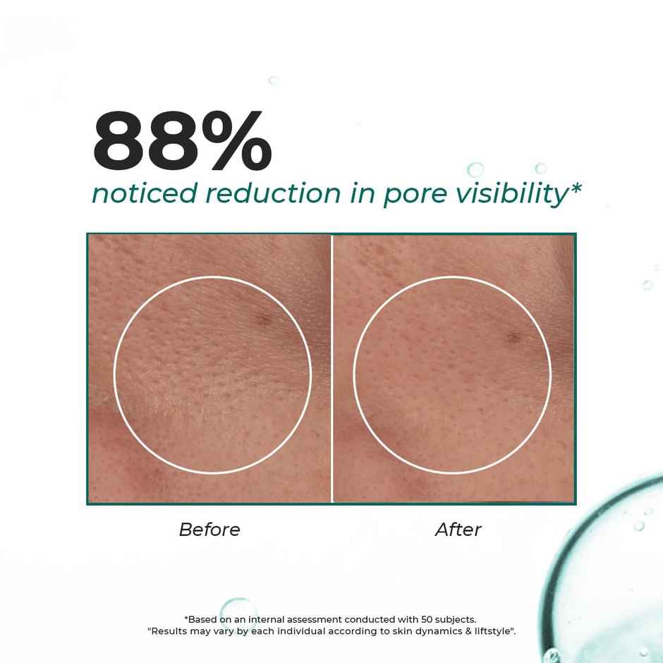 Conscious Chemist Blackhead Melting Water with Succinic & Glycolic Acid for Clear, Smooth Skin